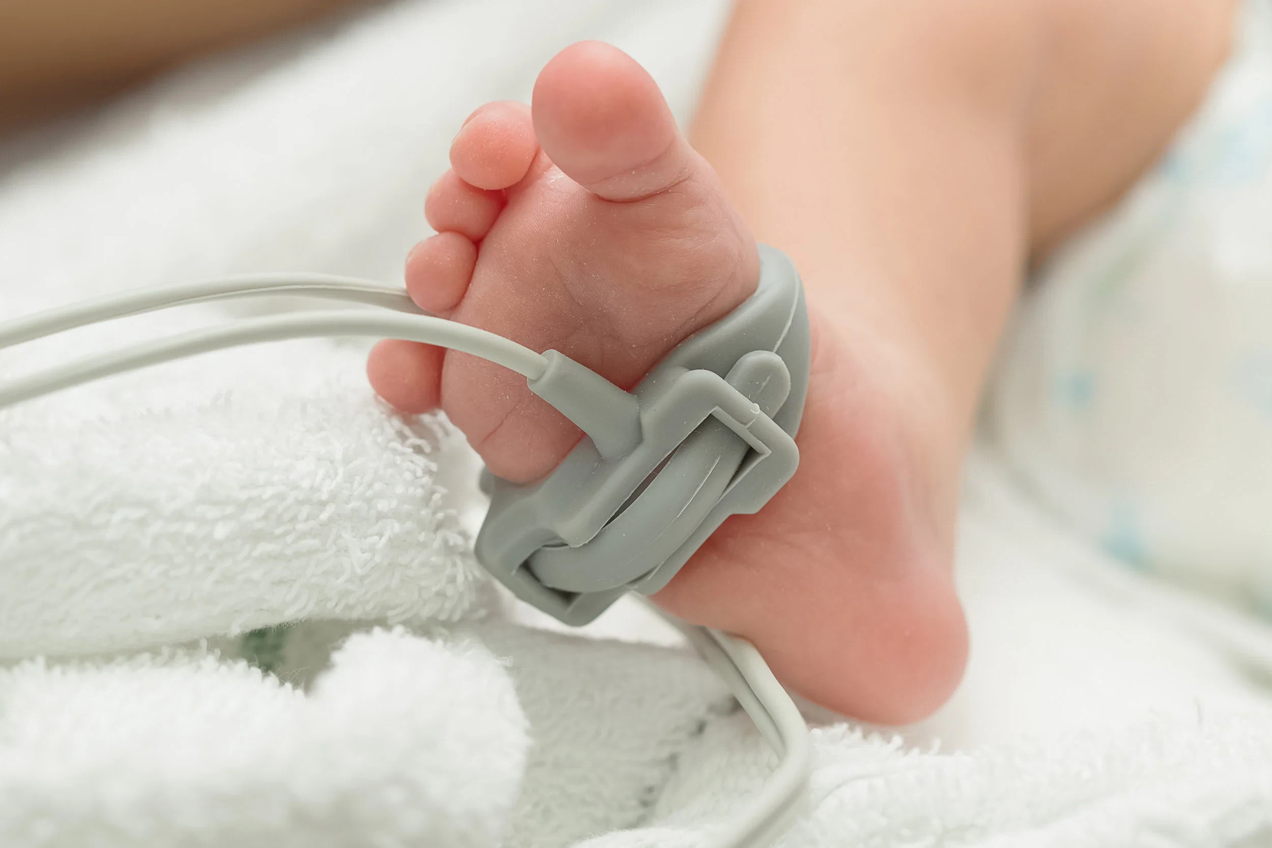 Precisión de las lecturas del sensor de oxígeno en sangre en recién nacidos